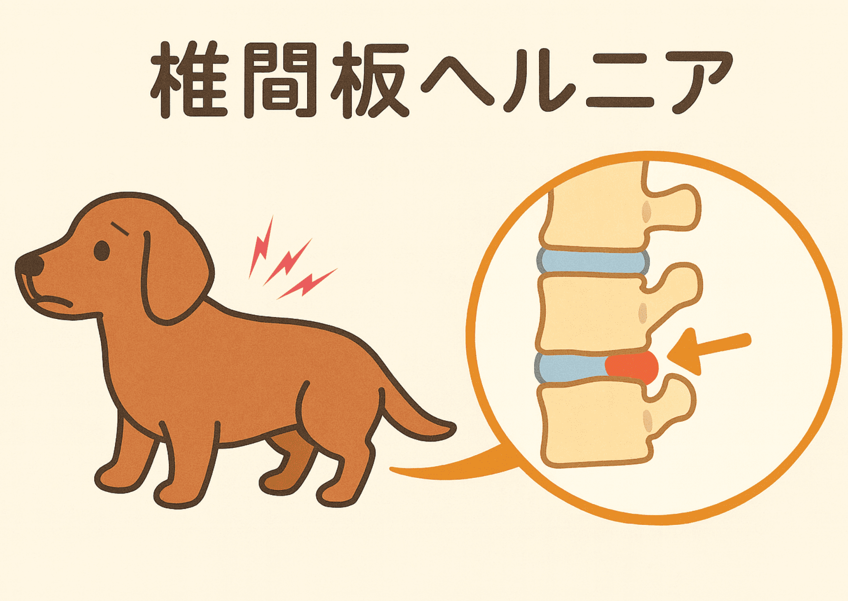 図解「犬の椎間板ヘルニア」：劣化により骨の隙間にある内部のゼリー状の物質が飛び出し、背に痛みが出る